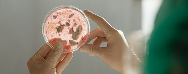 Petri dish, microbial culture, mold testing, mold test